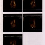 the birth