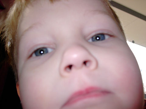 aag
