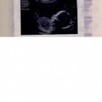 Scan - 19 weeks 4 days